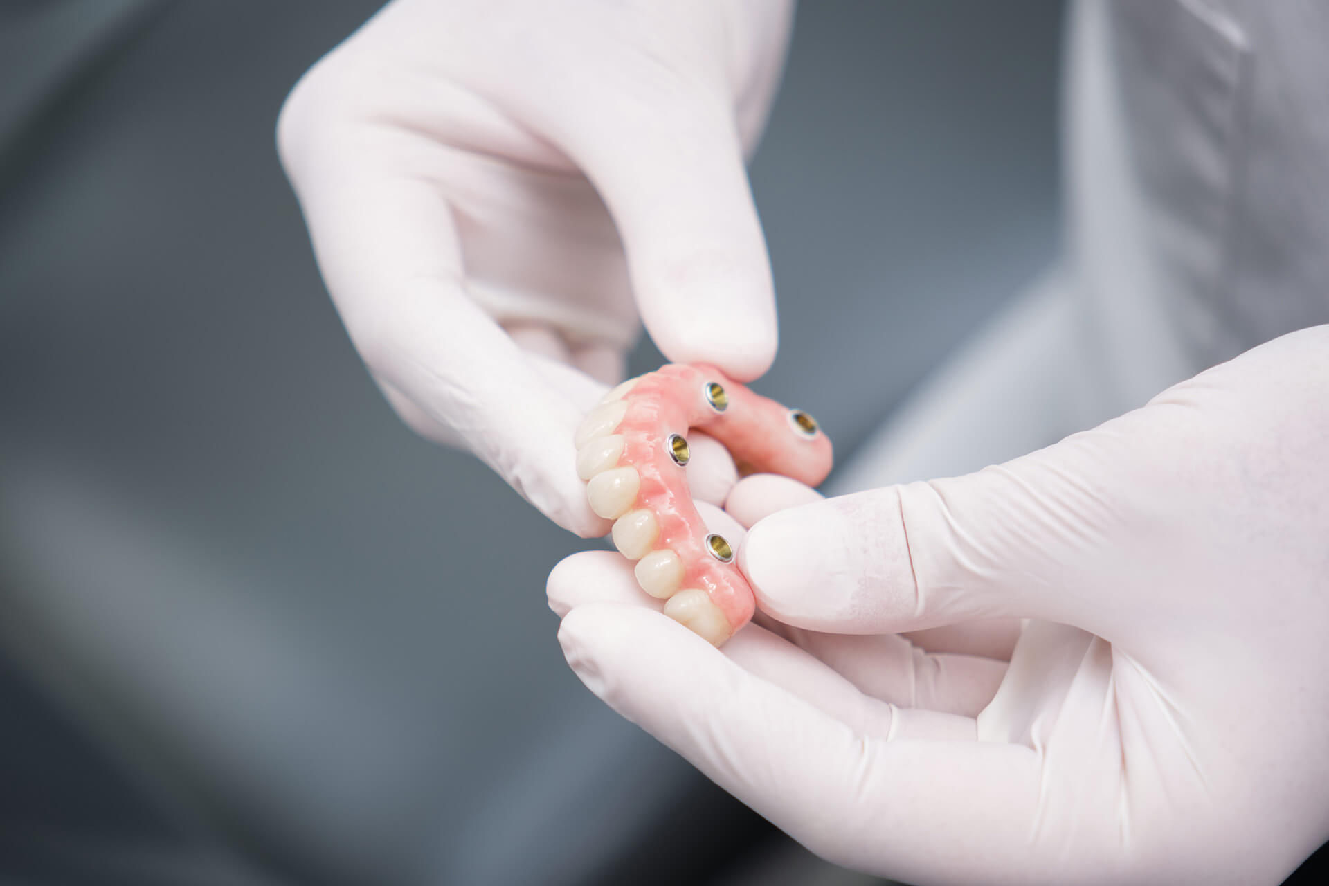 ADG083 https://implant-centre-martinko.eu/wp-content/uploads/2025/07/ADG083.jpg