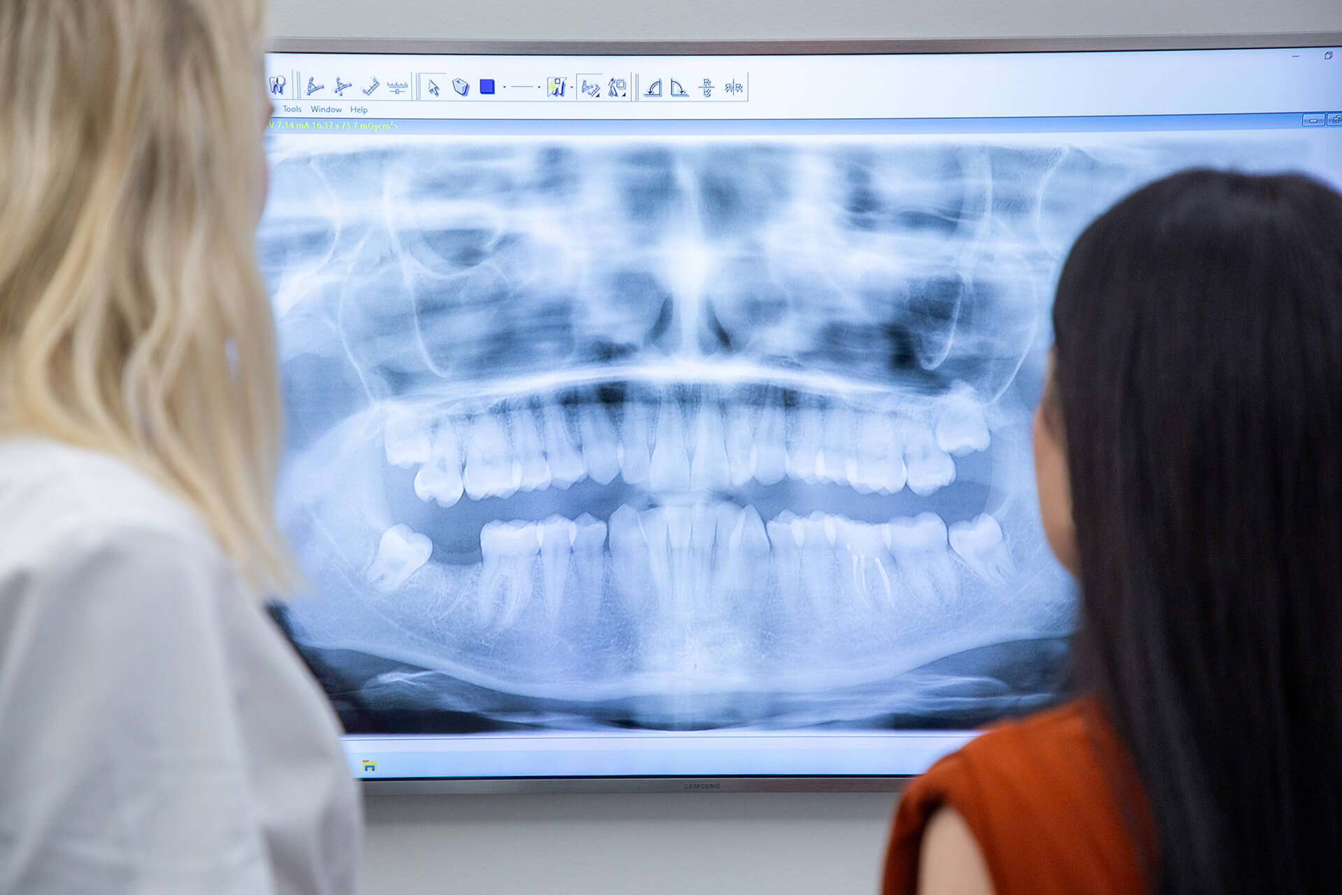 ICMveljača25-23 https://implant-centre-martinko.eu/wp-content/uploads/2025/07/ICMveljaca25-23.jpg